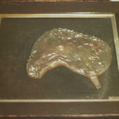 Stomach in Wax