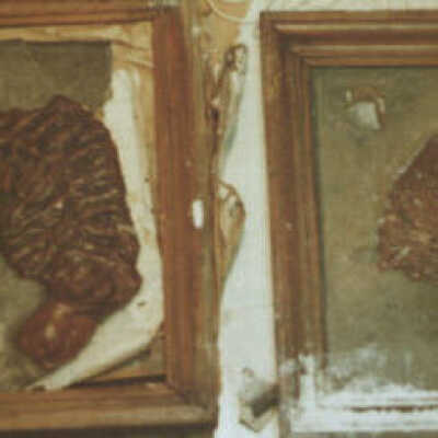 "Books" of Pathological Anatomy - 8t