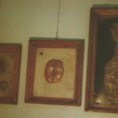 "Books" of Pathological Anatomy - 5t