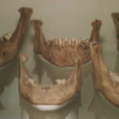 Human Jaws