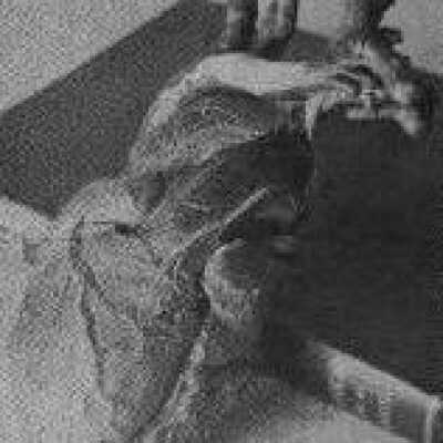 Foetal Heart