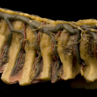 Wax-veins