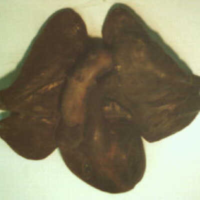 Model of the Heart and Lungs