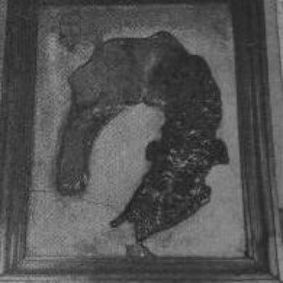 "Books" of Pathological Anatomy