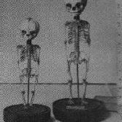 Foetal Skeletons