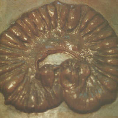 "Books" of Pathological Anatomy - 9t
