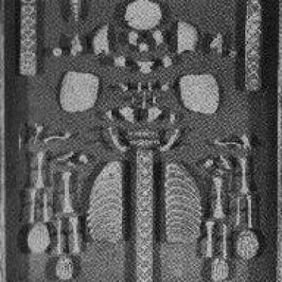 Bones of Foetal Skeleton