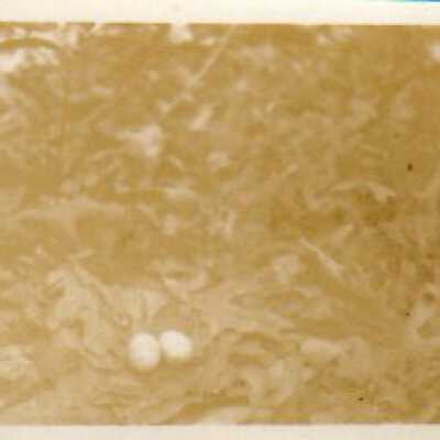Bird eggs