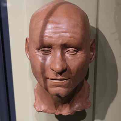 Skull Reconstruction