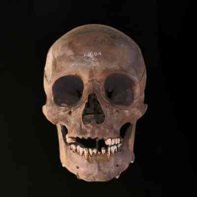 Human Skull