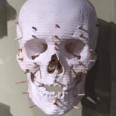 Skull Reconstruction