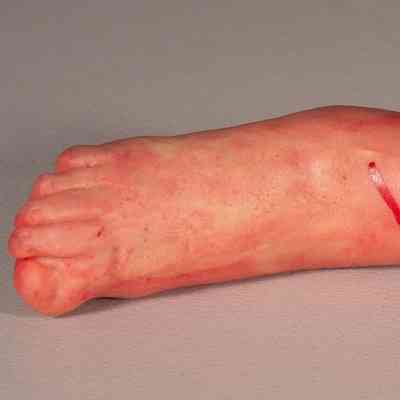 Severed limbs- Feet
