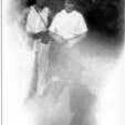 Man and Woman