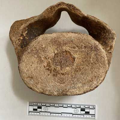 Vertebra