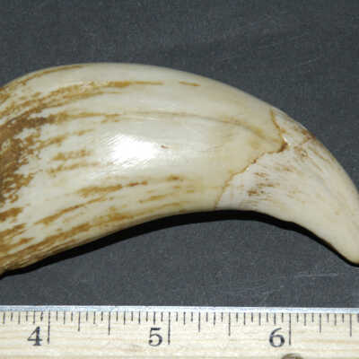 Tooth