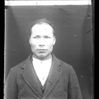 Man with cataract - Negative, Glass-plate