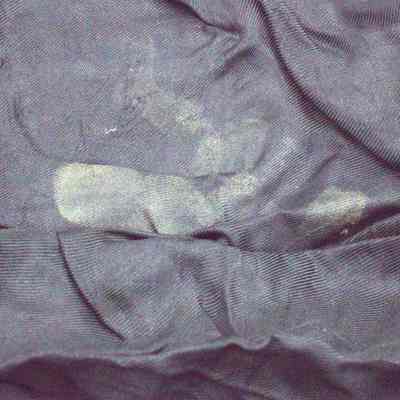stain on 2024.1016.36