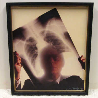 William Likoff, M.D. with Chest X-ray