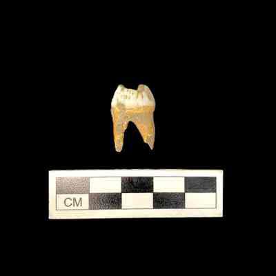 Human Molar Tooth