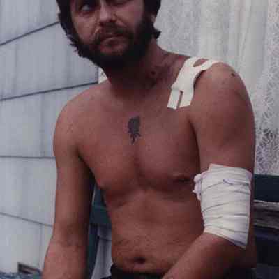 A photo view of an injured man, John Touchton. 10/09/1990.