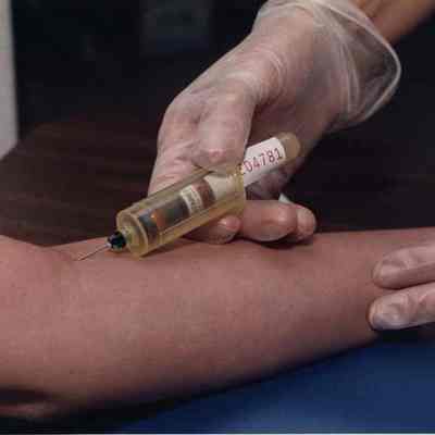 A photo view of blood being taken for Aides testing. 10/24/1991